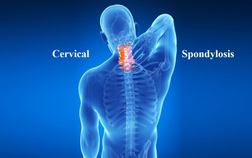 Cervical Pain Chiropractic Treatment